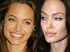 Angelina Jolie před a po